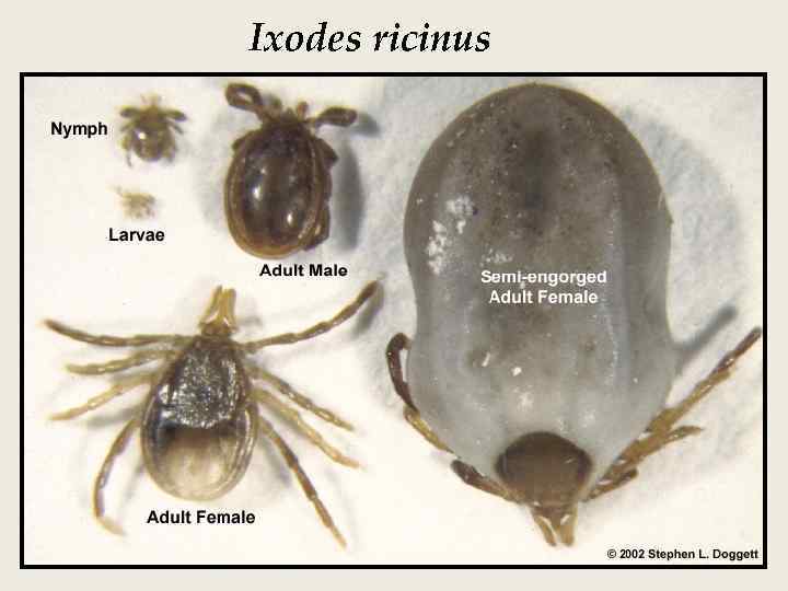 Ixodes ricinus 