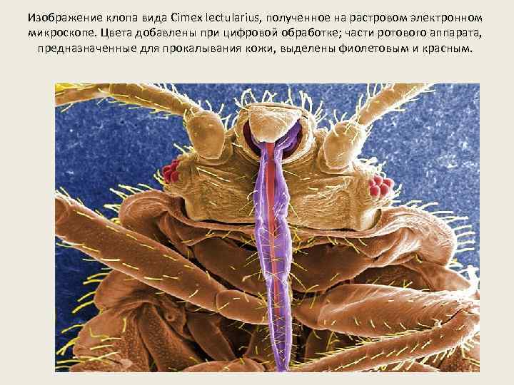 Изображение клопа вида Cimex lectularius, полученное на растровом электронном микроскопе. Цвета добавлены при цифровой