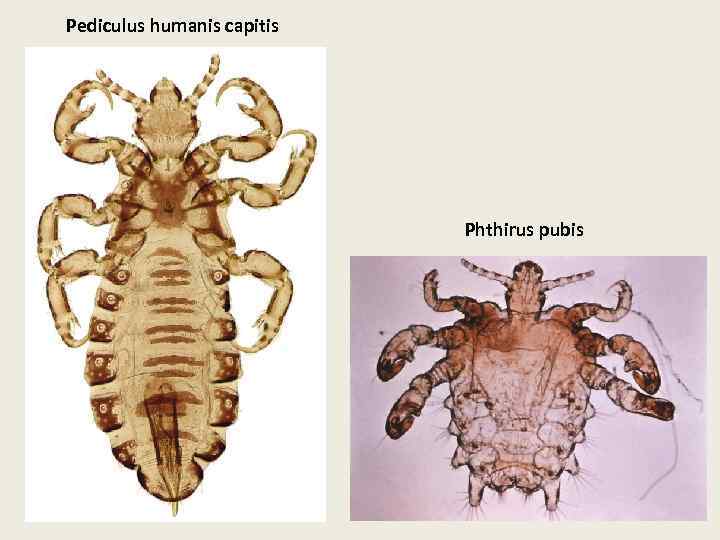 Pediculus humanis capitis Phthirus pubis 