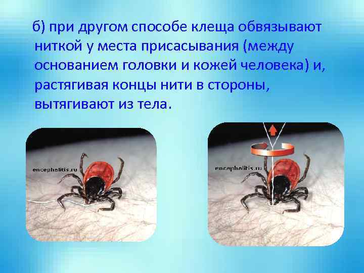 б) при другом способе клеща обвязывают ниткой у места присасывания (между основанием головки и