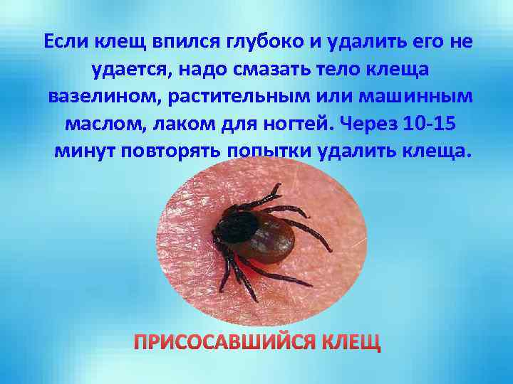 Если клещ впился глубоко и удалить его не удается, надо смазать тело клеща вазелином,