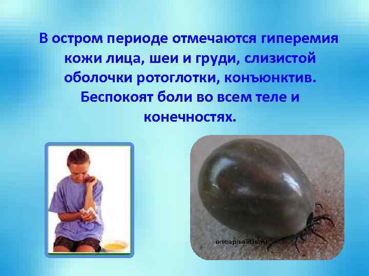 В остром периоде отмечаются гиперемия кожи лица, шеи и груди, слизистой оболочки ротоглотки, конъюнктив.