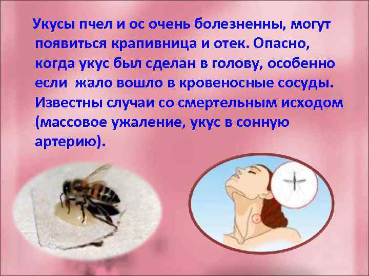  Укусы пчел и ос очень болезненны, могут появиться крапивница и отек. Опасно, когда