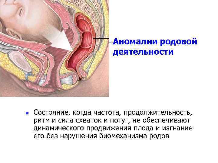 Аномалии родовой деятельности n Состояние, когда частота, продолжительность, ритм и сила схваток и потуг,