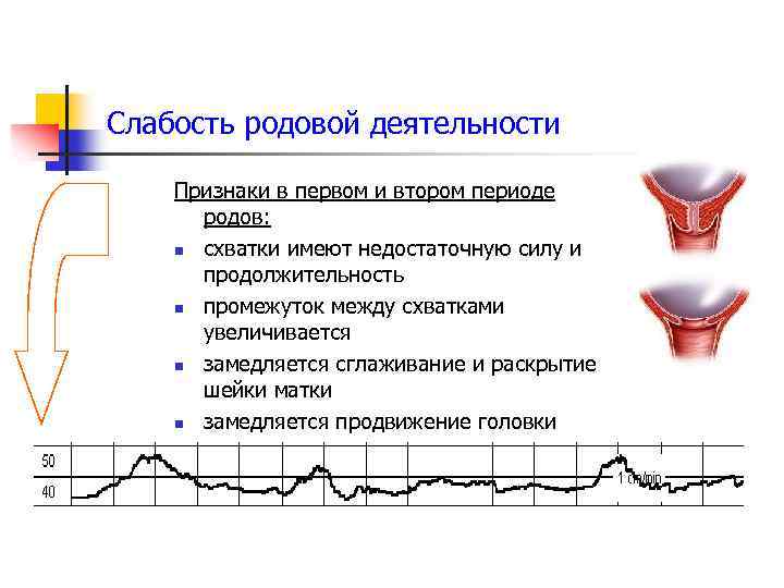 Слабость родовой деятельности Признаки в первом и втором периоде родов: n схватки имеют недостаточную