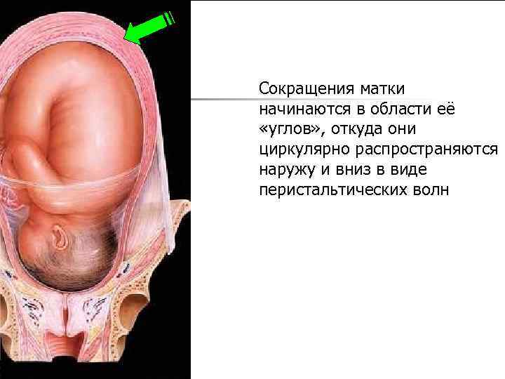 Сокращения матки начинаются в области её «углов» , откуда они циркулярно распространяются наружу и