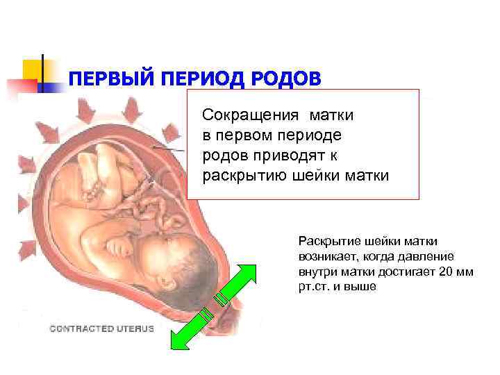 ПЕРВЫЙ ПЕРИОД РОДОВ Сокращения матки в первом периоде родов приводят к раскрытию шейки матки