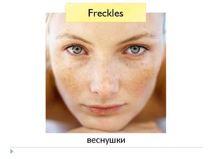 Freckles веснушки 