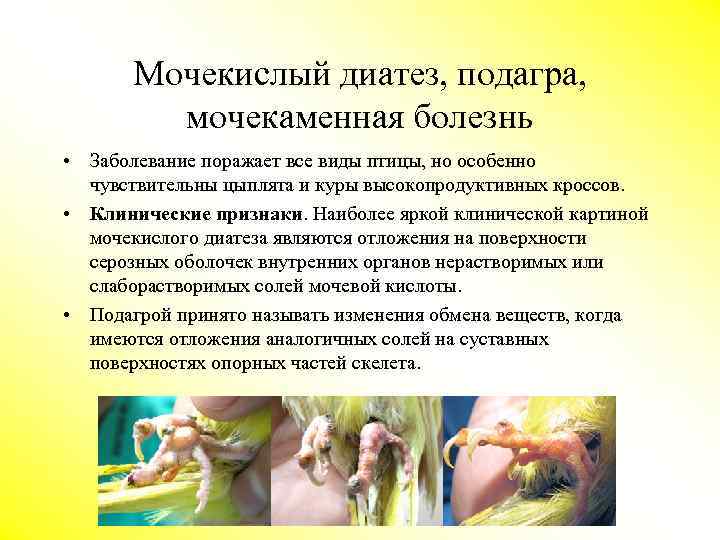 Мочекислый диатез, подагра, мочекаменная болезнь • Заболевание поражает все виды птицы, но особенно чувствительны