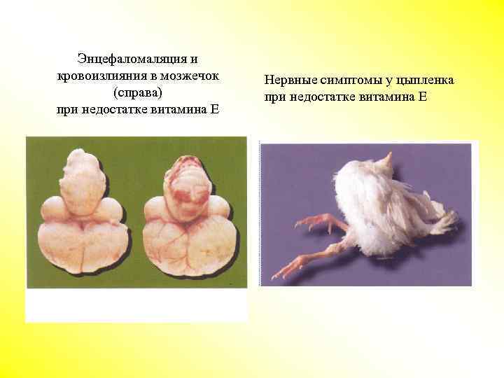 Энцефаломаляция и кровоизлияния в мозжечок (справа) при недостатке витамина Е Нервные симптомы у цыпленка