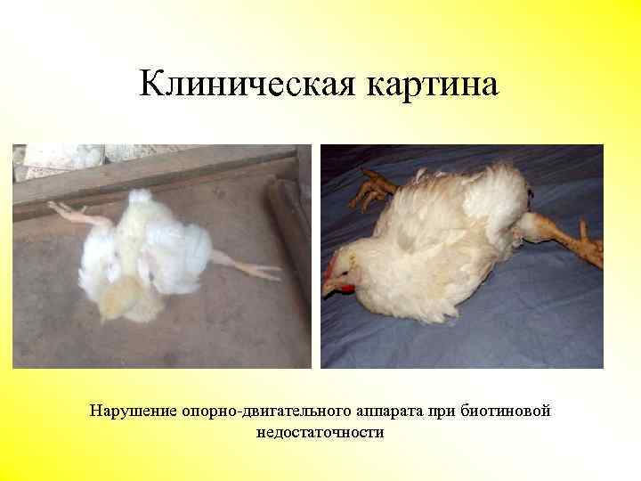 Клиническая картина Нарушение опорно-двигательного аппарата при биотиновой недостаточности 