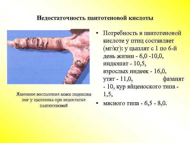 Недостаточность пантотеновой кислоты Язвенное воспаление кожи подошвы ног у цыпленка при недостатке пантотеновой •