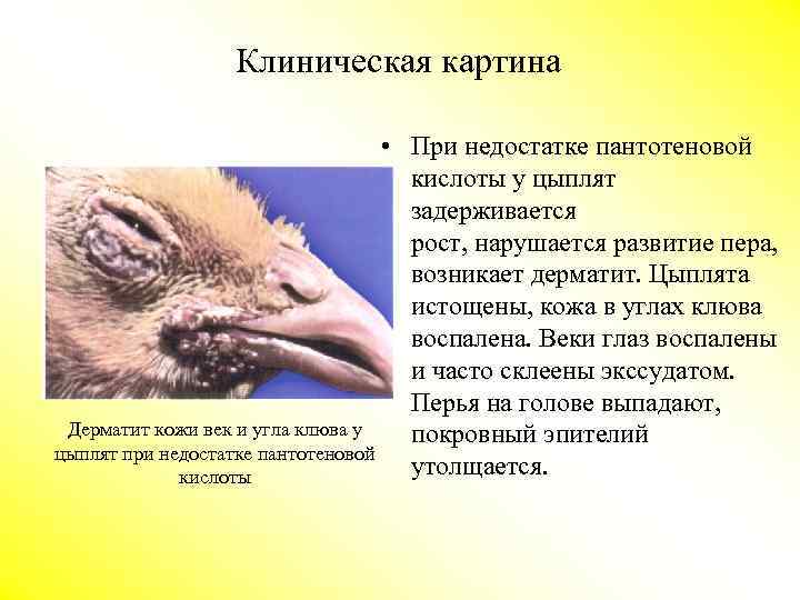 Клиническая картина • При недостатке пантотеновой кислоты у цыплят задерживается рост, нарушается развитие пера,