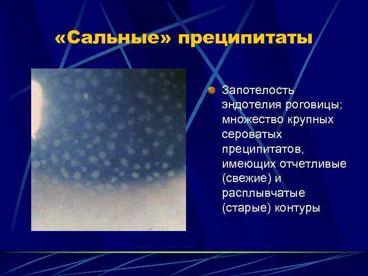  «Сальные» преципитаты Запотелость эндотелия роговицы; множество крупных сероватых преципитатов, имеющих отчетливые (свежие) и