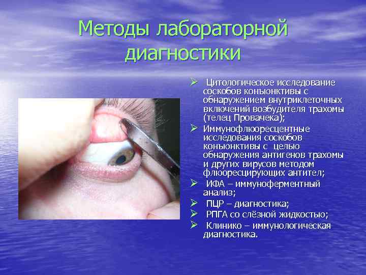 Методы лабораторной диагностики Ø Цитологическое исследование Ø Ø Ø соскобов конъюнктивы с обнаружением внутриклеточных