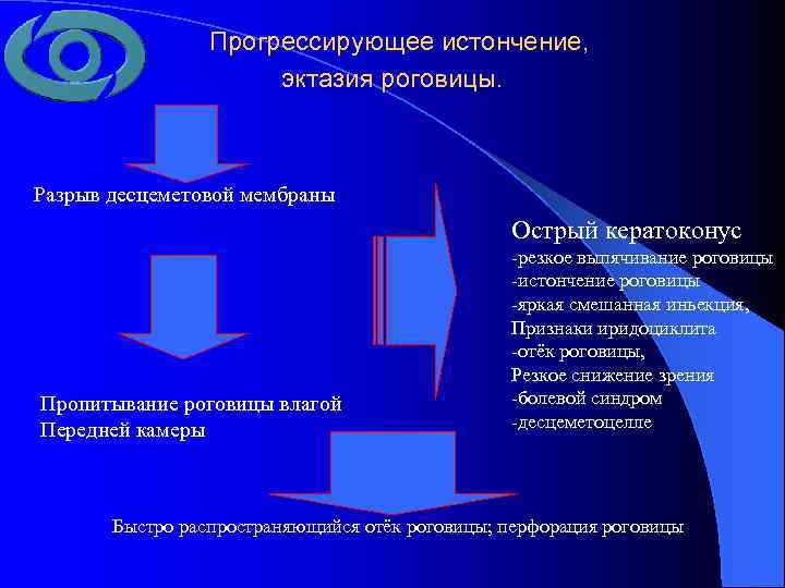 Прогрессирующее истончение, эктазия роговицы. Разрыв десцеметовой мембраны Острый кератоконус Пропитывание роговицы влагой Передней камеры