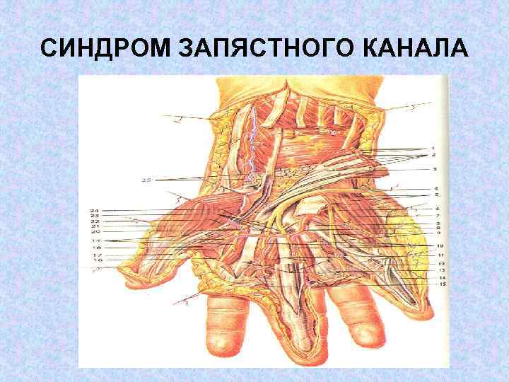 СИНДРОМ ЗАПЯСТНОГО КАНАЛА 