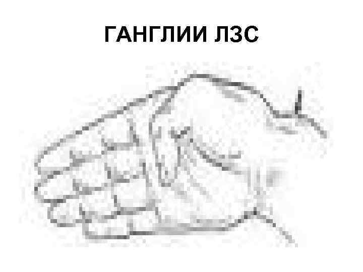 ГАНГЛИИ ЛЗС 