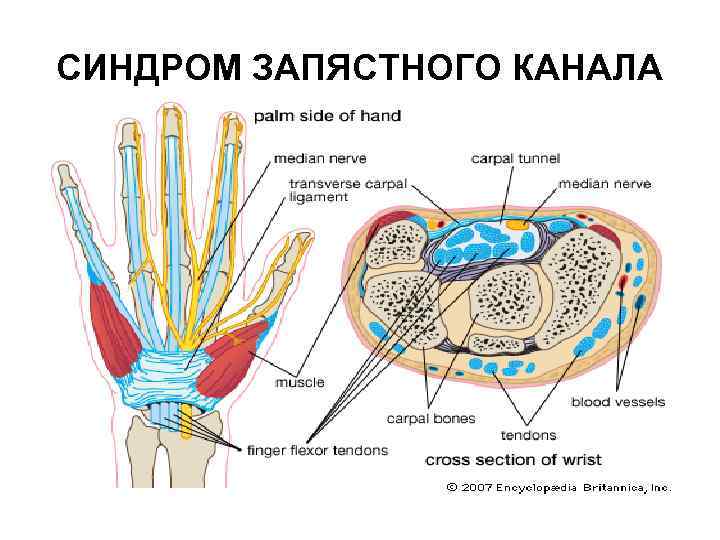 Синдром канала запястья. Канал Гийона топографическая анатомия. Каналы запястья топографическая анатомия. Лучевой запястный канал. Строение запястного канала.