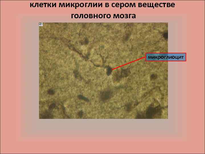 клетки микроглии в сером веществе головного мозга микроглиоцит 