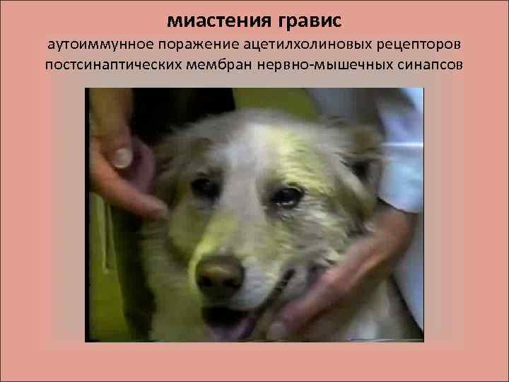 миастения гравис аутоиммунное поражение ацетилхолиновых рецепторов постсинаптических мембран нервно-мышечных синапсов 