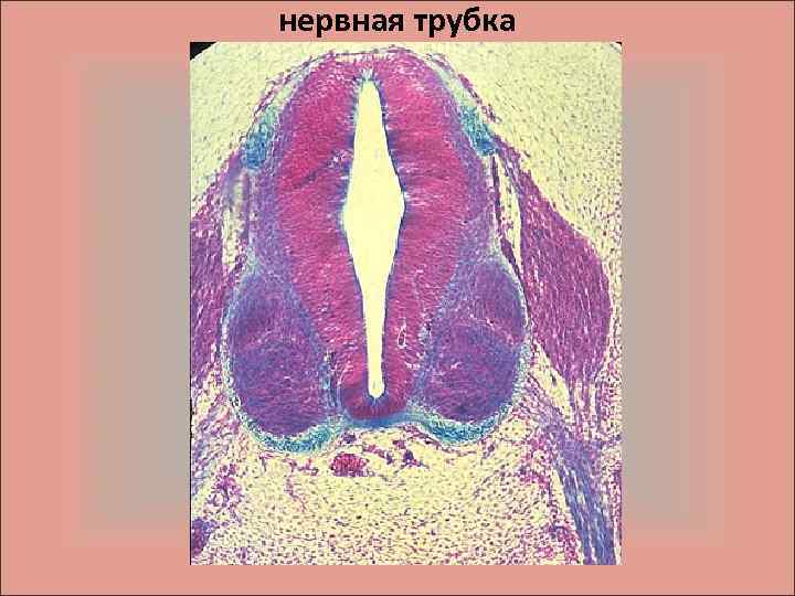 нервная трубка 