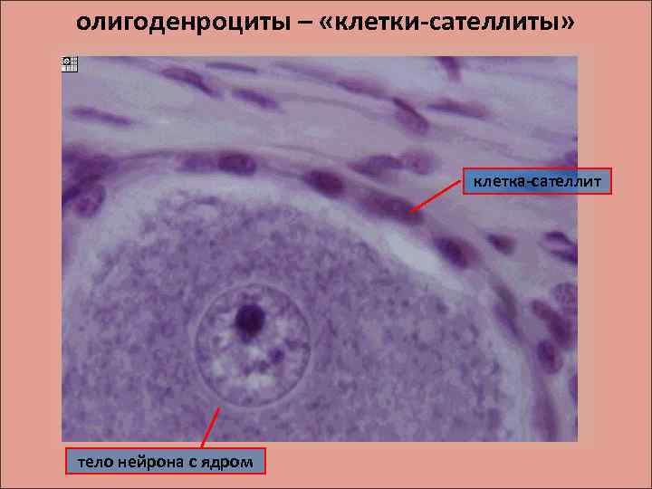 олигоденроциты – «клетки-сателлиты» клетка-сателлит тело нейрона с ядром 