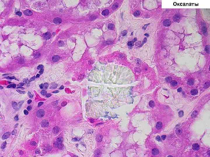 Оксалаты 