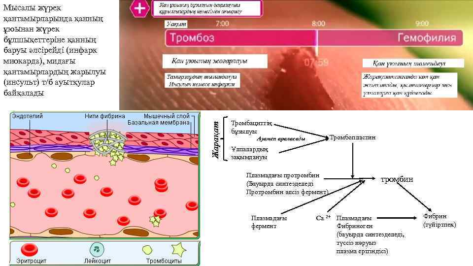 Жарақат Мысалы жүрек қантамырларында қанның ұюынан жүрек бұлшықеттеріне қанның баруы әлсірейді (инфарк миокарда), мидағы