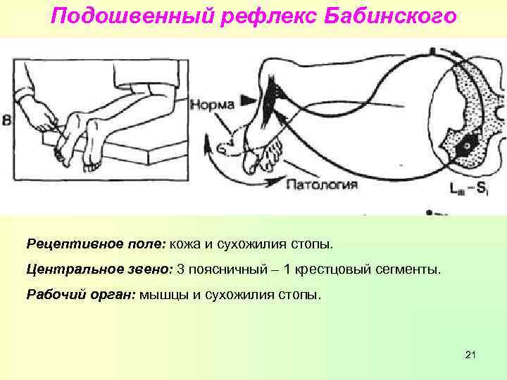 Подошвенный рефлекс Бабинского Рецептивное поле: кожа и сухожилия стопы. Центральное звено: 3 поясничный –