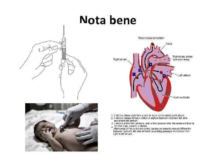 Nota bene 