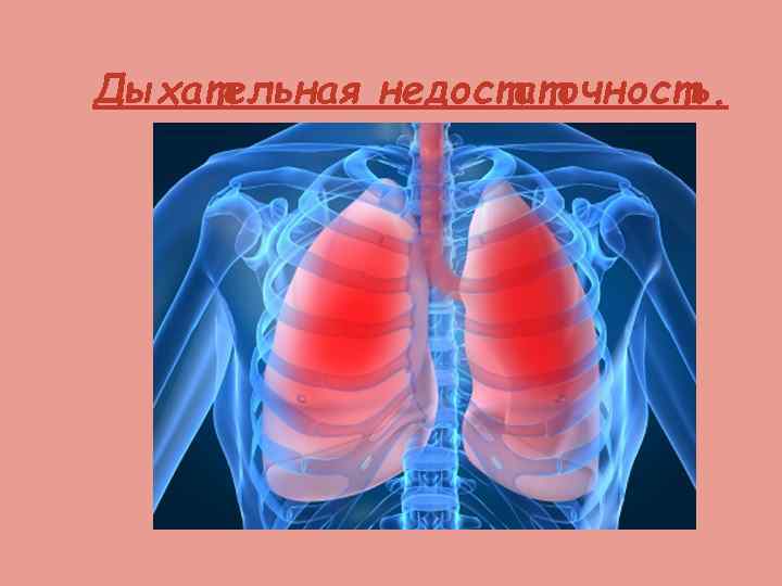 Дыхательная недостаточность. 