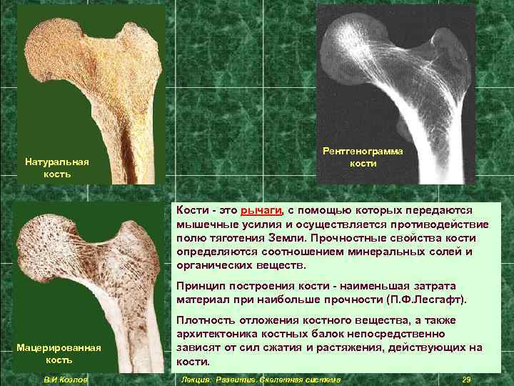 Строение костей в рентгеновском изображении возрастные особенности