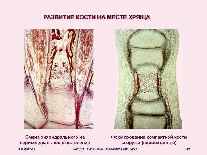 Развитие кости на месте хряща рисунок