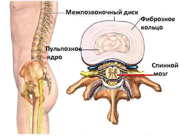 Межпозвоночный диск Пульпозное ядро Фиброзное кольцо Спинной мозг 