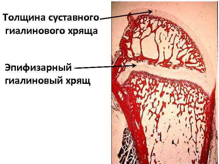 Гиалиновый хрящ рисунок