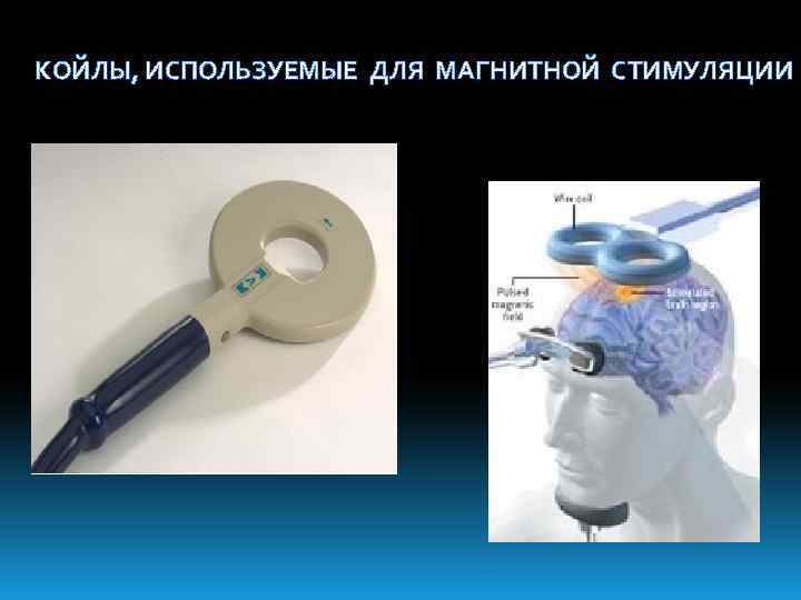 КОЙЛЫ, ИСПОЛЬЗУЕМЫЕ ДЛЯ МАГНИТНОЙ СТИМУЛЯЦИИ 