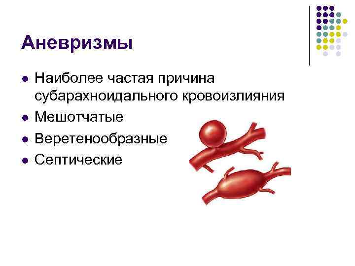Аневризмы l l Наиболее частая причина субарахноидального кровоизлияния Мешотчатые Веретенообразные Септические 