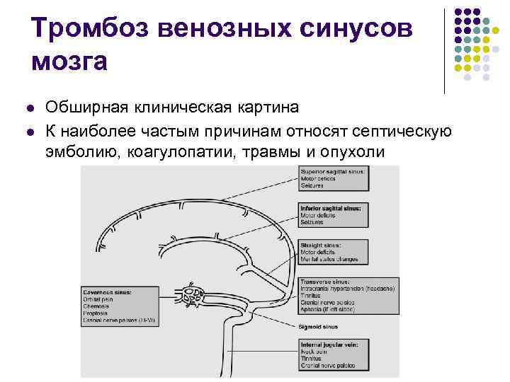 Тромбоз венозных синусов мозга l l Обширная клиническая картина К наиболее частым причинам относят