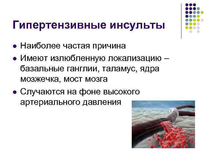 Гипертензивные инсульты l l l Наиболее частая причина Имеют излюбленную локализацию – базальные ганглии,