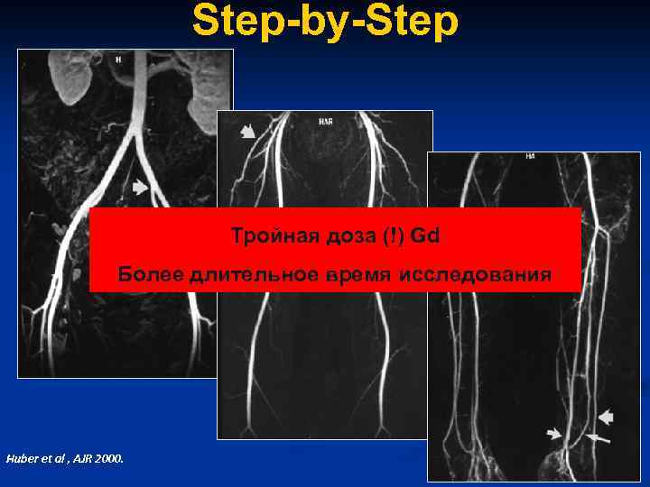 Step-by-Step Тройная доза (!) Gd Более длительное время исследования Huber et al , AJR