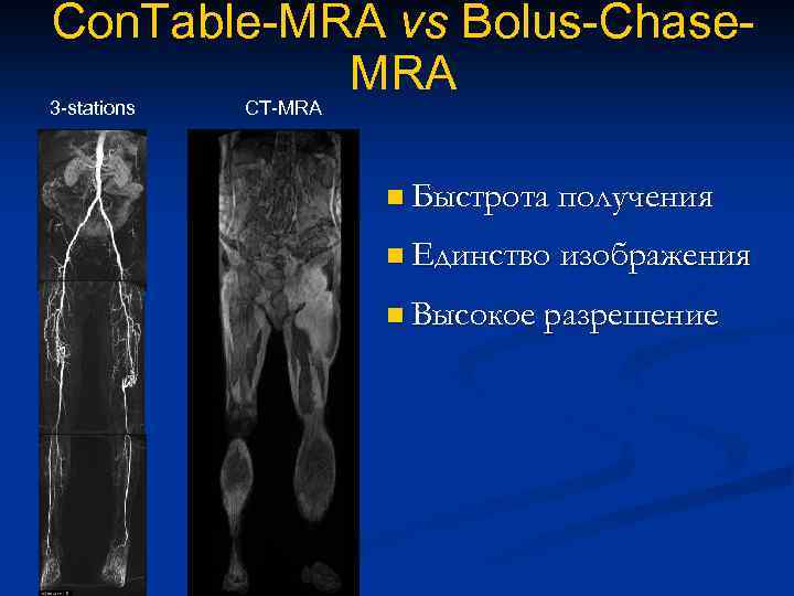 Con. Table-MRA vs Bolus-Chase. MRA 3 -stations CT-MRA n Быстрота получения n Единство изображения