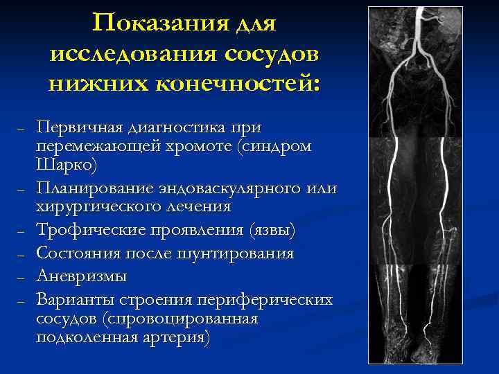 Показания для исследования сосудов нижних конечностей: – – – Первичная диагностика при перемежающей хромоте