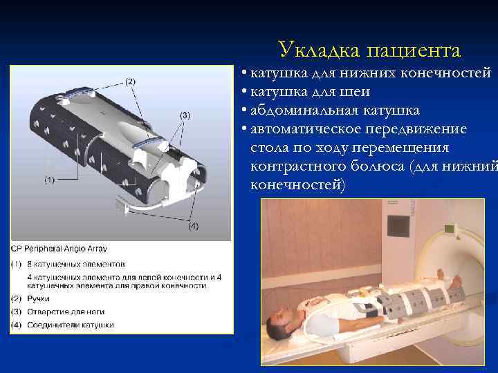 Укладка пациента • катушка для нижних конечностей • катушка для шеи • абдоминальная катушка