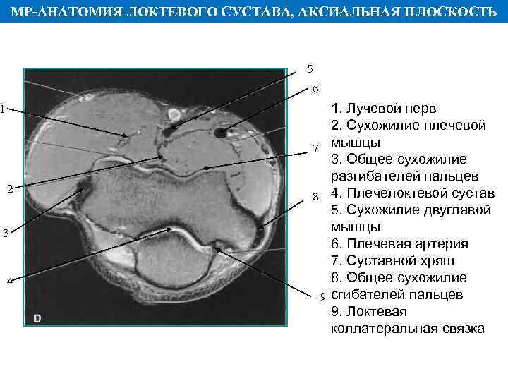 Локтевой сустав фото анатомия