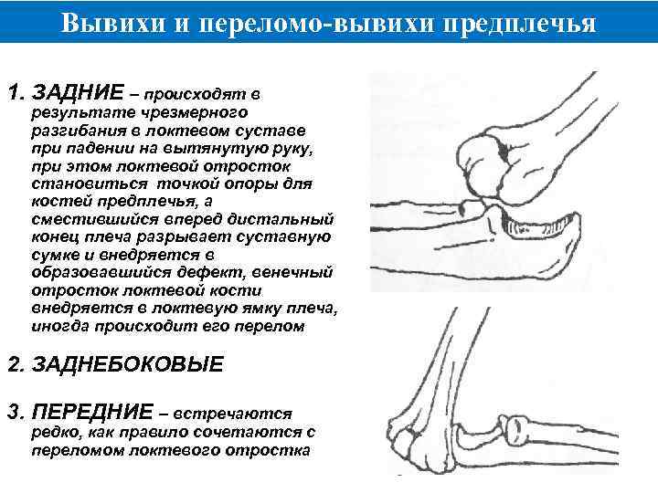 Вывихи и их лечение хирургия презентация