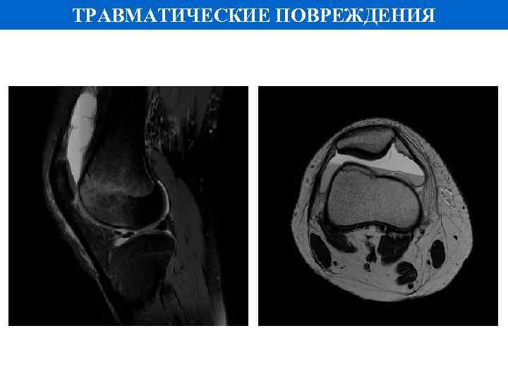 ТРАВМАТИЧЕСКИЕ ПОВРЕЖДЕНИЯ 