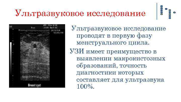 Видеолекции узи изранов. Изранов протоколы УЗИ. Изранов лекции по УЗИ гинекология. УЗИ имеет существенные ограничения в исследовании. Фазы менструального цикла по УЗИ.