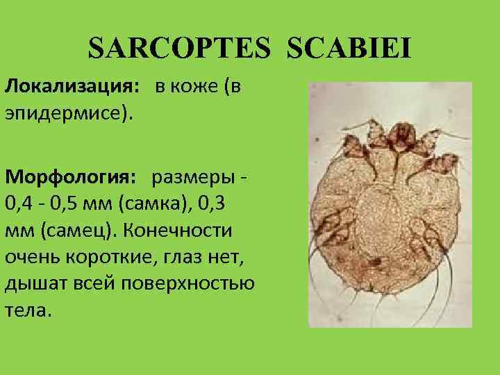 Почему чесоточного клеща часто называют зуднем ответ. Чесоточный зудень (Sarcoptes scabiei). Чесоточный клещ Sarcoptes scabiei Hominis. Чесоточный зудень Sarcoptes scabiei строение. Клещ Sarcoptes scabiei возбудитель чесотки.