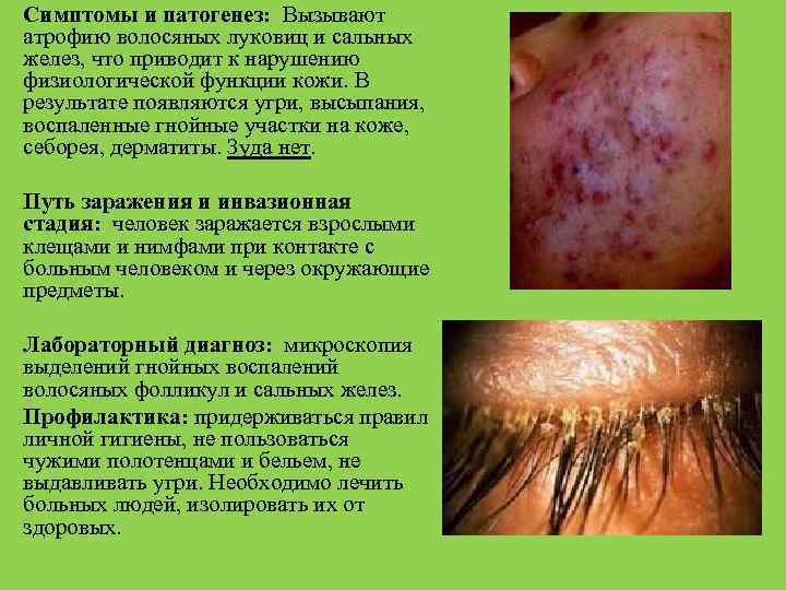 Симптомы и патогенез: Вызывают атрофию волосяных луковиц и сальных желез, что приводит к нарушению